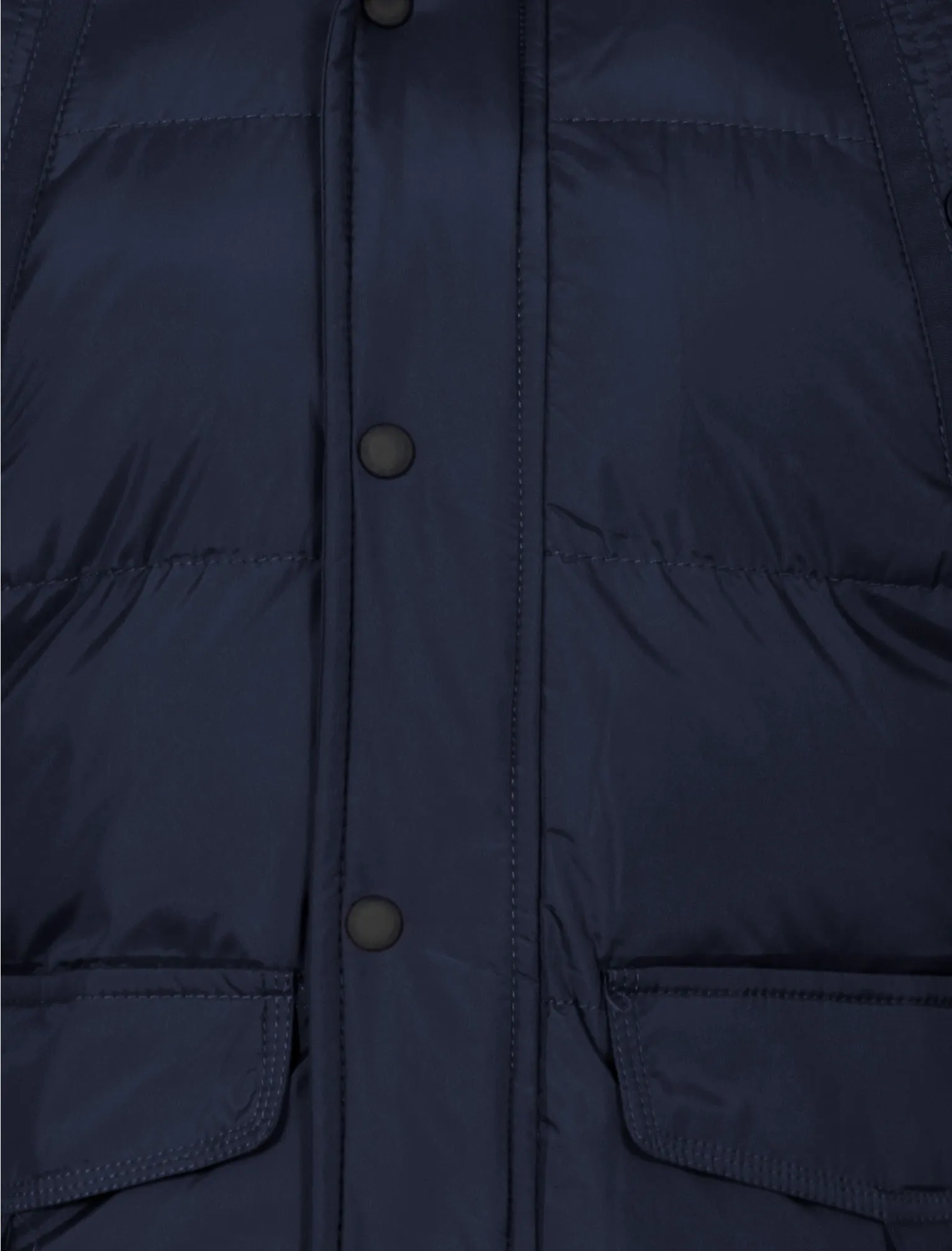 Padded detachable hooded coat in navy - Dissident